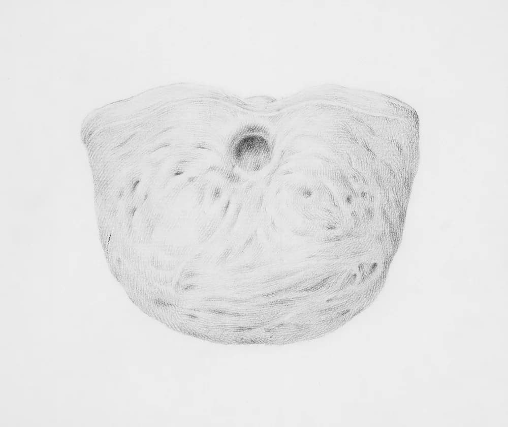 Bladder Image